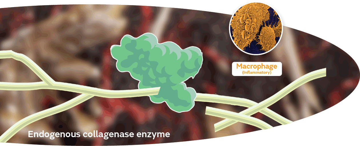 delays keep wounds chronic