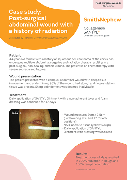 Post-surgical abdominal wound with a history of radiation