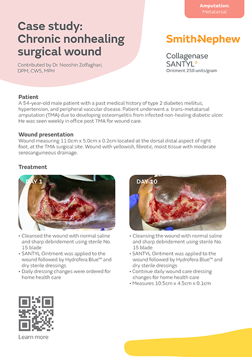 Chronic nonhealing surgical wound
